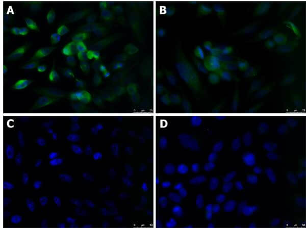 Immunofluorescence Microscopy of Rabbit anti-KLF4 antibody Immunofluorescence Microscopy of Rabbit anti-KLF4 antibody