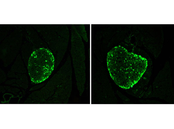Glucagon Antibody