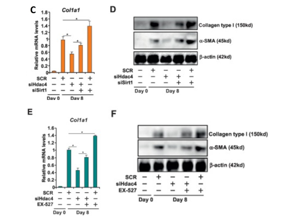 qPCR and Western Blot of Anti-Collagen Type I qPCR and Western Blot of Anti-Collagen Type I