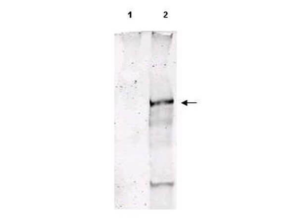 Anti-ATM pS1981 Antibody - Western Blot Anti-ATM pS1981 Antibody - Western Blot