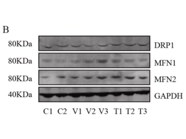 Western blot using goat Anti-Mouse IgG DyLight800 Western blot using goat Anti-Mouse IgG DyLight800
