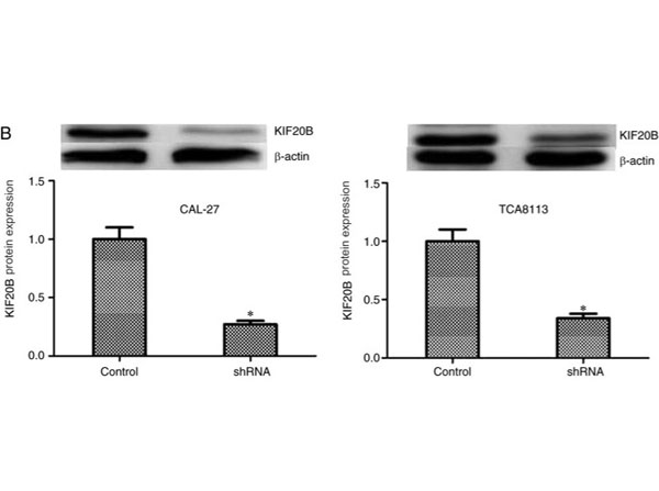 Western Blot results using Goat F(ab')2 Anti-Rabbit IgG Antibody Western Blot results using Goat F(ab')2 Anti-Rabbit IgG Antibody