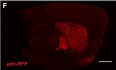 Immunohistochemistry of Anti-RFP Immunohistochemistry of Anti-RFP