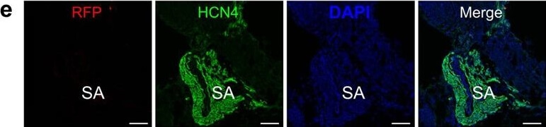 Immunohistochemistry of Anti-RFP Immunohistochemistry of Anti-RFP