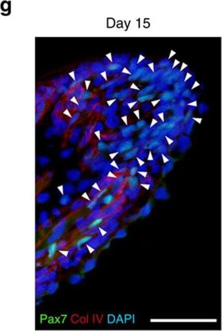 Immunohistochemistry of Anti-Collagen Type IV Immunohistochemistry of Anti-Collagen Type IV
