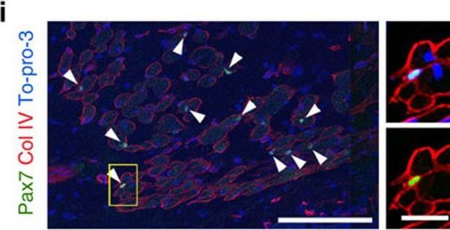 Immunohistochemistry of Anti-Collagen Type IV Immunohistochemistry of Anti-Collagen Type IV
