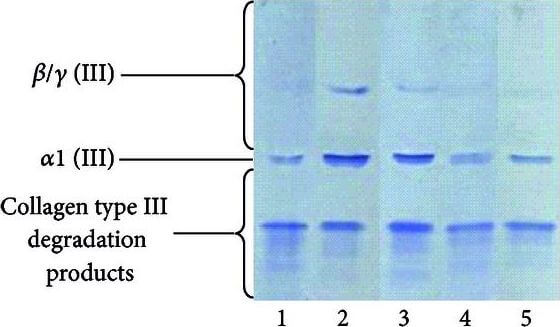 Western Blot of Anti-Collagen Type III Western Blot of Anti-Collagen Type III
