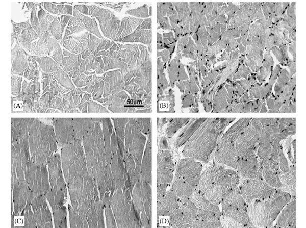 Immunohistochemistry using BSA Immunohistochemistry using BSA