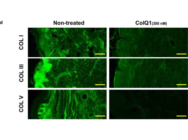 Immunocytochemistry of Anti-Collagen Type I Immunocytochemistry of Anti-Collagen Type I