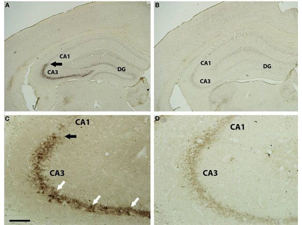 Immunohistochemistry using Mouse Brain Tissue