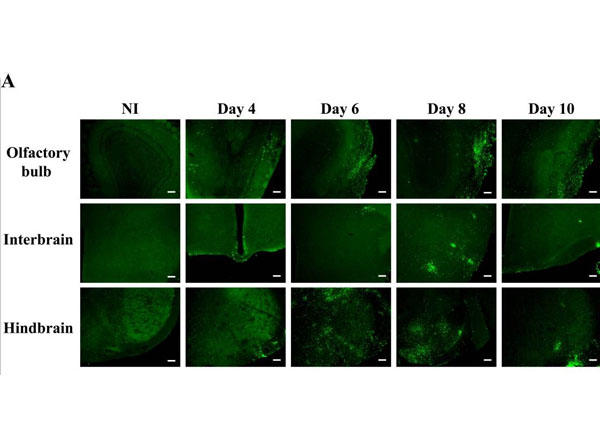 Immunohistochemistry using Chicken Serum Immunohistochemistry using Chicken Serum
