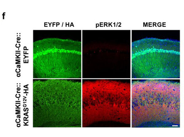 Immunohistochemistry using Goat Serum Immunohistochemistry using Goat Serum