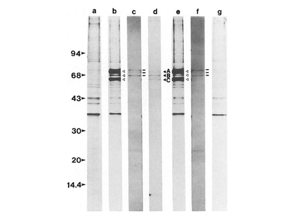 Immunoprecipitation using Guinea Pig Serum Immunoprecipitation using Guinea Pig Serum
