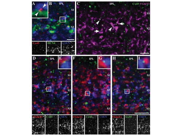 Immunofluorescence using Donkey Serum Immunofluorescence using Donkey Serum