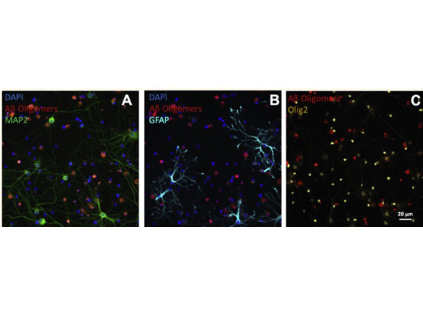 Immunofluorescence using Donkey Serum Immunofluorescence using Donkey Serum
