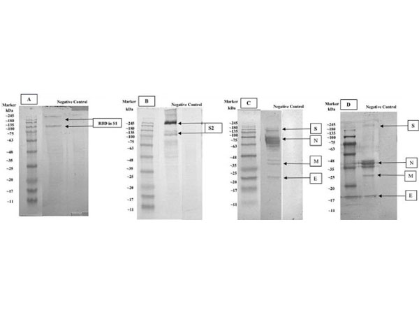 Western Blot using DAB Western Blot using DAB