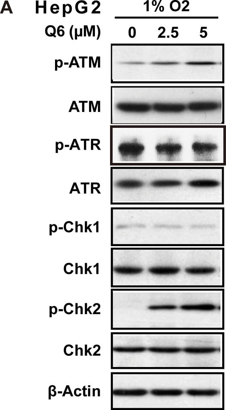 Western Blot of Anti-ATM Western Blot of Anti-ATM