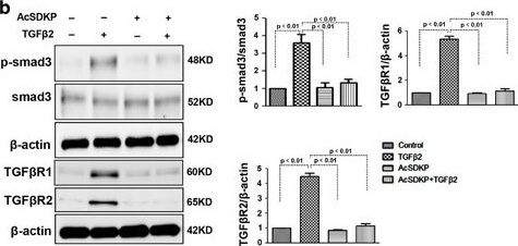 Western Blot of Anti-SMAD3 pS423 pS425 Western Blot of Anti-SMAD3 pS423 pS425