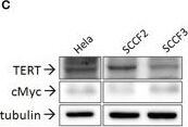 Western Blot of Anti-hTERT Western Blot of Anti-hTERT