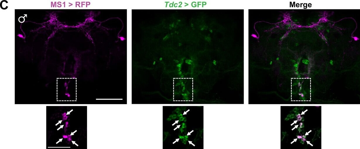 Immunohistochemistry of Anti-RFP Immunohistochemistry of Anti-RFP