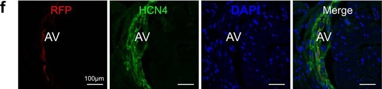 Immunohistochemistry of Anti-RFP Immunohistochemistry of Anti-RFP