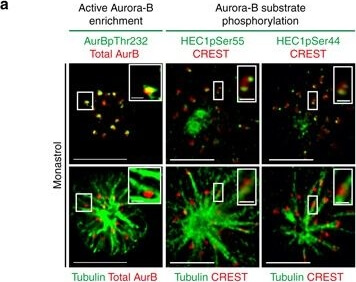 Immunocytochemistry of Anti-Aurora B pT232 Immunocytochemistry of Anti-Aurora B pT232