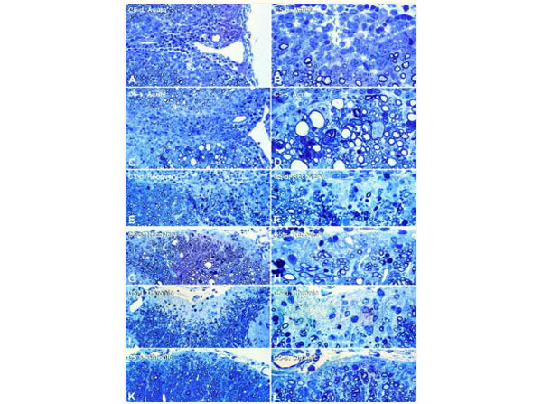 Assays using Guinea Pig Spinal Cord Assays using Guinea Pig Spinal Cord