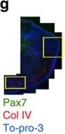 Immunohistochemistry of Anti-Collagen Type IV Immunohistochemistry of Anti-Collagen Type IV