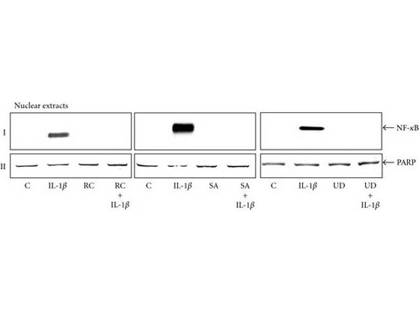 Western Blot of Anti-NFKB p65 pS529 Antibody Western Blot of Anti-NFKB p65 pS529 Antibody