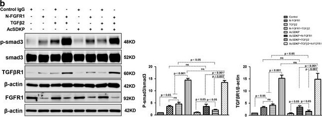 Western Blot of Anti-SMAD3 pS423 pS425 Western Blot of Anti-SMAD3 pS423 pS425