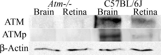 Western Blot of Mouse Anti-ATM pS 1981 Western Blot of Mouse Anti-ATM pS 1981