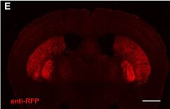 Immunohistochemistry of Anti-RFP Immunohistochemistry of Anti-RFP