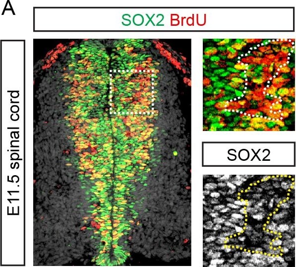 Immunohistochemistry of Anti-BrdU Immunohistochemistry of Anti-BrdU
