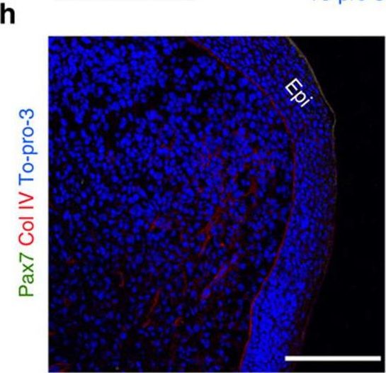 Immunohistochemistry of Anti-Collagen Type IV Immunohistochemistry of Anti-Collagen Type IV