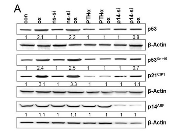 Western Blot using Goat Anti-Rabbit Western Blot using Goat Anti-Rabbit