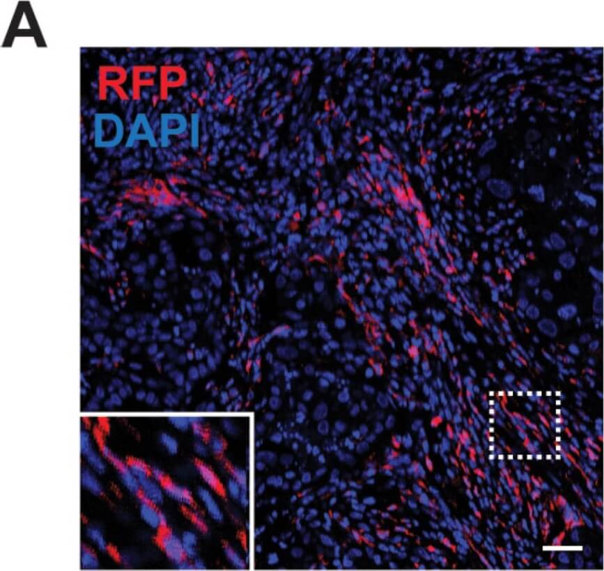 Immunohistochemistry of Goat Anti-RFP Immunohistochemistry of Goat Anti-RFP