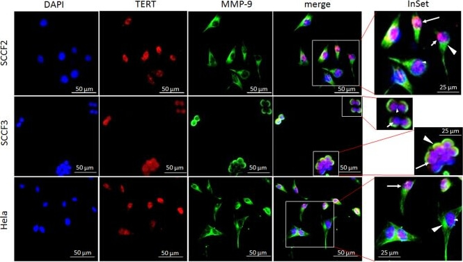 Immunocytochemistry of Anti-hTERT Immunocytochemistry of Anti-hTERT