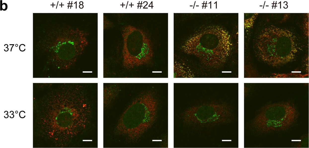 Immunocytochemistry of Anti-Collagen Type I Immunocytochemistry of Anti-Collagen Type I
