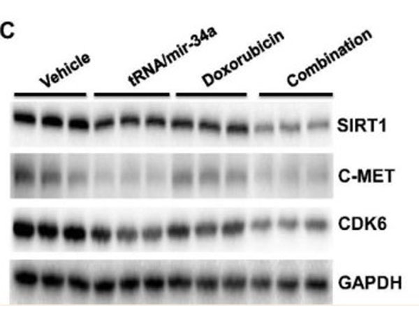 RIPA used for western blot RIPA used for western blot
