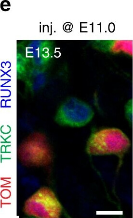 Immunocytochemistry of Chicken Anti-RFP Immunocytochemistry of Chicken Anti-RFP