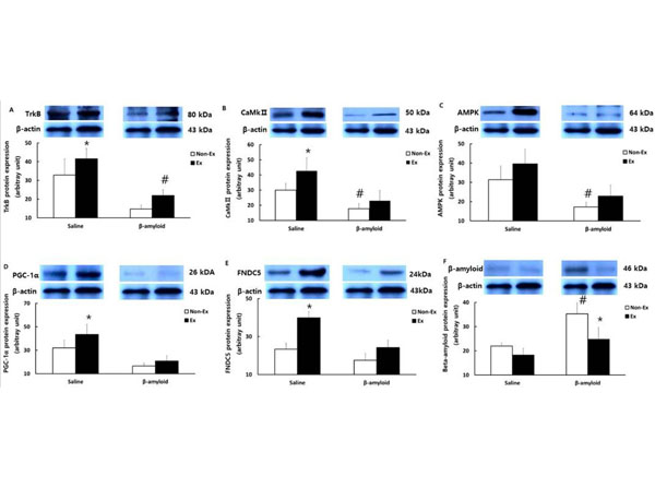 Western Blots using RIPA Western Blots using RIPA