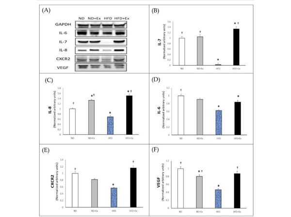 Western Blots using RIPA Western Blots using RIPA