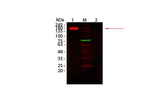 Western blot using MB-070 Western blot using MB-070