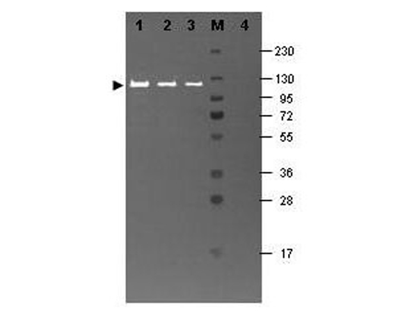 Western blot using MB-070 Western blot using MB-070