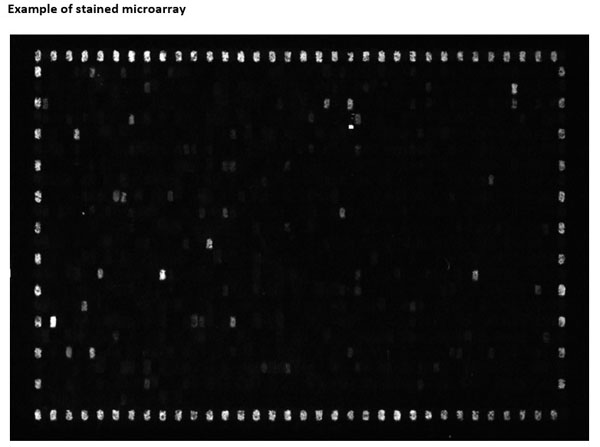 Microarray using Goat Anti-Human IgG DyLight™549 Microarray using Goat Anti-Human IgG DyLight™549