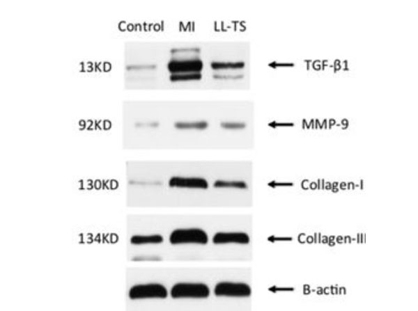 RIPA used for western blot RIPA used for western blot