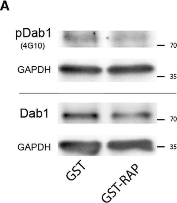 Western Blot of Anti-Dab1 (400-555) Western Blot of Anti-Dab1 (400-555)