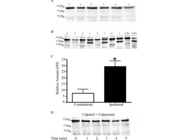 Western Blot using Mouse Brain Western Blot using Mouse Brain