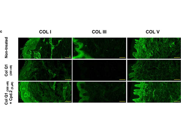 Immunocytochemistry of Anti-Collagen Type I Immunocytochemistry of Anti-Collagen Type I