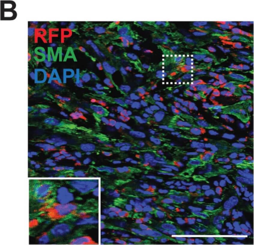 Immunohistochemistry of Goat Anti-RFP Immunohistochemistry of Goat Anti-RFP